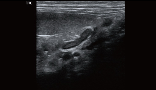 Adrenal gland of canine